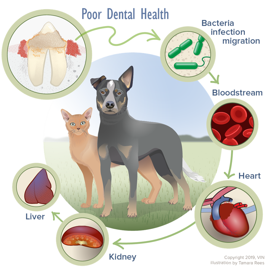 Graphic illustrating the progression of dental disease.